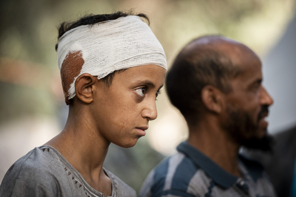 Enfant blessé maroc